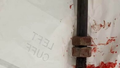 صورة تعبيرية لفريق من أطباء قصر العيني داخل غرفة العمليات يجرون جراحة دقيقة لإنقاذ حياة مريض.